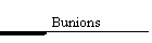 Bunions